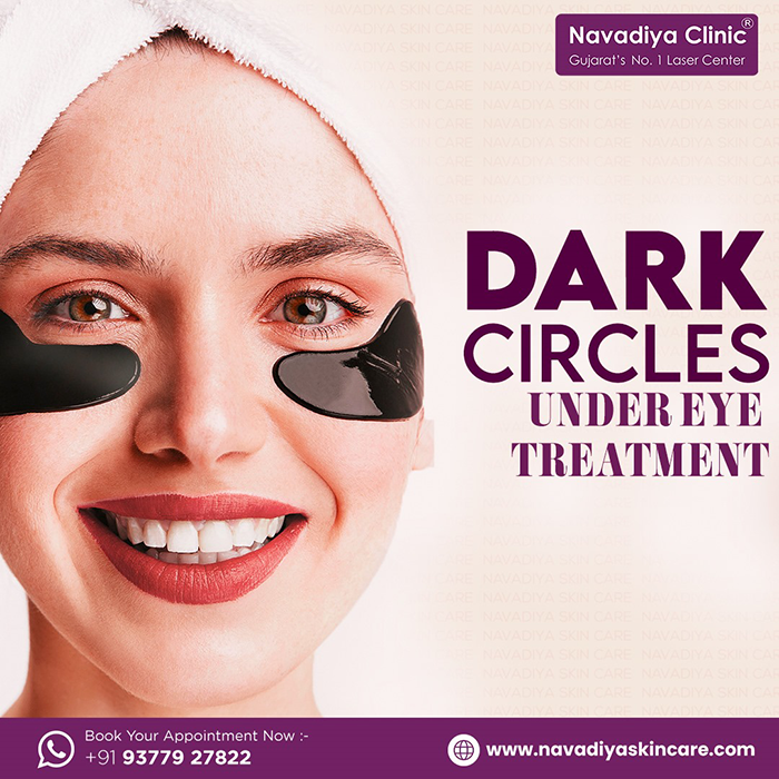 Best Under Eye Dark Circles Treatment